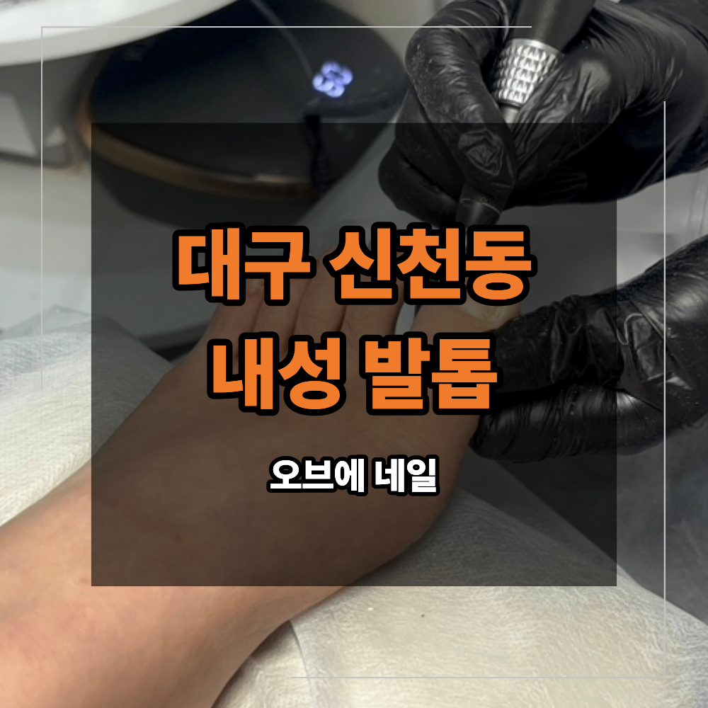 대구 신천동 내성 발톱 무좀 케어 왜 깎을수록 더 파고들까?